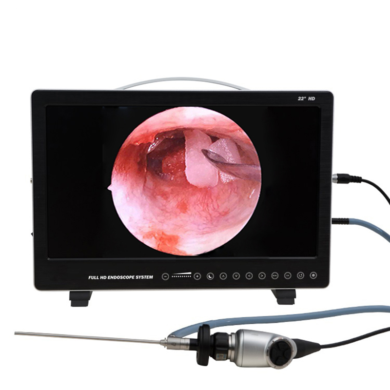 22 Inch Endoscope Camera Syste - Laptop Accessories All In One recension och pris